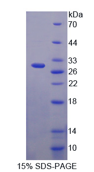 62kDa核孔蛋白(NUP62)重组蛋白
