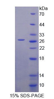 70kDa热休克蛋白12B(HSPA12B)重组蛋白