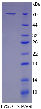70kDa热休克蛋白1B(HSPA1B)重组蛋白