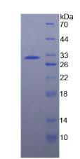 70kDa热休克蛋白4(HSPA4)重组蛋白