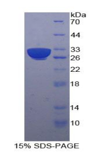 70kDa热休克蛋白9(HSPA9)重组蛋白