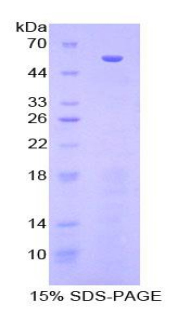 70kDa热休克蛋白结合蛋白1(HSPBP1)重组蛋白