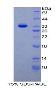 88kDa核孔蛋白(NUP88)重组蛋白