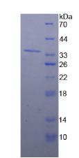 98kDa核孔蛋白(NUP98)重组蛋白