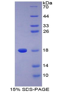 ⅡA组磷脂酶A2(PLA2G2A)重组蛋白