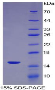 ⅡD组磷脂酶A2(PLA2G2D)重组蛋白