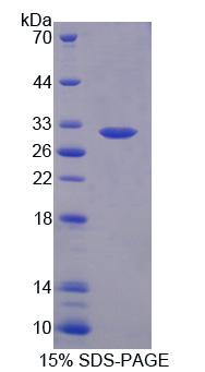 Ⅲ组磷脂酶A2(PLA2G3)重组蛋白