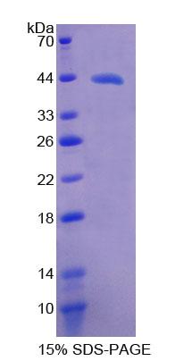 ⅣD组磷脂酶A2(PLA2G4D)重组蛋白