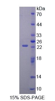 AMPA离子能谷氨酸受体3(GRIA3)重组蛋白