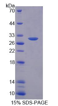 ATP结合盒转运蛋白C10(ABCC10)重组蛋白