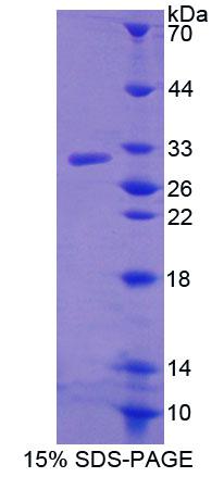 ATP结合盒转运蛋白C11(ABCC11)重组蛋白