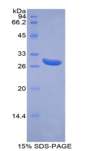 ATP结合盒转运蛋白G1(ABCG1)重组蛋白