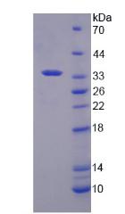 ATP结合盒转运蛋白G2(ABCG2)重组蛋白