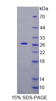 A类清道夫受体3(SCARA3)重组蛋白
