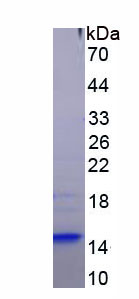 Bcl2拮抗/杀伤因子1(BAK1)重组蛋白