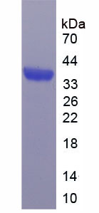 Bcl2相关髓细胞白血病序列1(MCL1)重组蛋白
