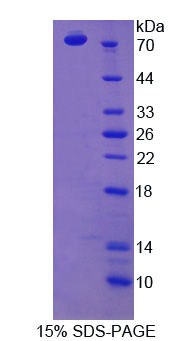 B类清道夫受体1(SCARB1)重组蛋白