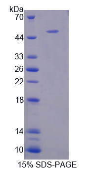 B-淋巴细胞激活抗原B7-1(LAB7-1)重组蛋白