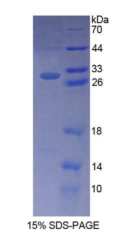 B-细胞淋巴瘤因子10(Bcl10)重组蛋白