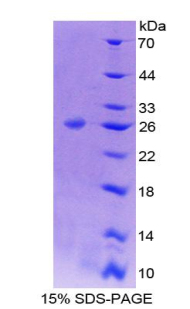 B-细胞淋巴瘤因子9(Bcl9)重组蛋白