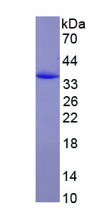 CD163分子(CD163)重组蛋白