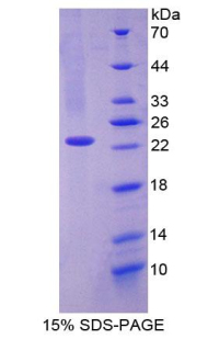 CD27结合蛋白(CD27BP)重组蛋白