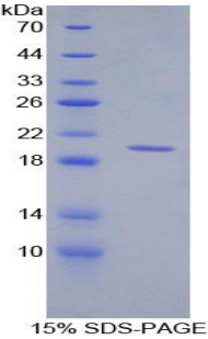 CD30配体(CD30L)重组蛋白