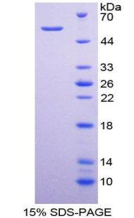 CD320分子(CD320)重组蛋白