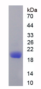 CD3d分子(CD3d)重组蛋白