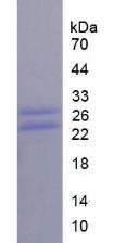 CD8a分子(CD8a)重组蛋白