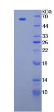 CUB带状疮疹透明区样域蛋白1(CUZD1)重组蛋白