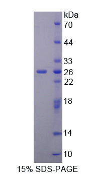 CUB域EGF样信号肽3(SCUBE3)重组蛋白