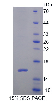 Cytospin B蛋白(CYTSB)重组蛋白