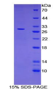 C-型凝集素域家族13成员A(CLEC13A)重组蛋白