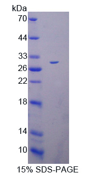 Deltex同源物1(DTX1)重组蛋白