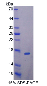 Dickkopf相关蛋白4(DKK4)重组蛋白