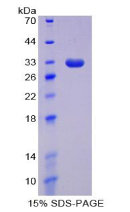 DNA甲基转移酶1(DNMT1)重组蛋白