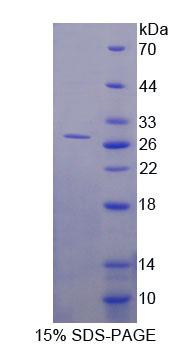DNA甲基转移酶3B(DNMT3B)重组蛋白
