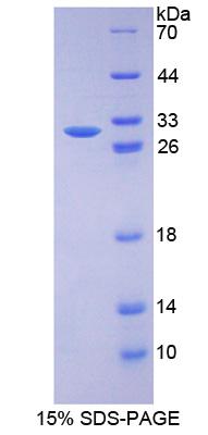 DNA修复蛋白RAD50(RAD50)重组蛋白