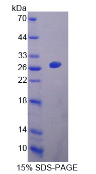 EB病毒诱导蛋白3(EBI3)重组蛋白