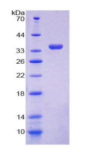 GDP解离抑制因子1(GDI1)重组蛋白