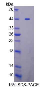GLI家族锌指蛋白1(GLI1)重组蛋白