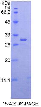 GLI家族锌指蛋白3(GLI3)重组蛋白