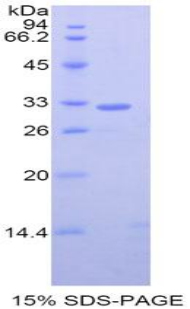 GRB2相关衔接蛋白2(GRAP2)重组蛋白