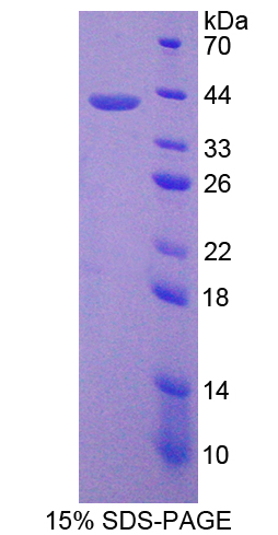 G蛋白β2(GNb2)重组蛋白