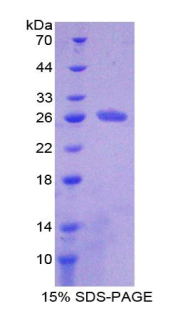 HAUS Augmin样复合体亚基7(HAUS7)重组蛋白
