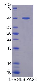 Kruppel样因子15(KLF15)重组蛋白