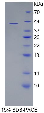 L1CAM同源物细胞粘附分子(CHL1)重组蛋白