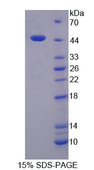 Lemur酪氨酸激酶3(LMTK3)重组蛋白