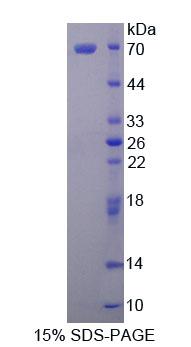 Matrin 3蛋白(MATR3)重组蛋白